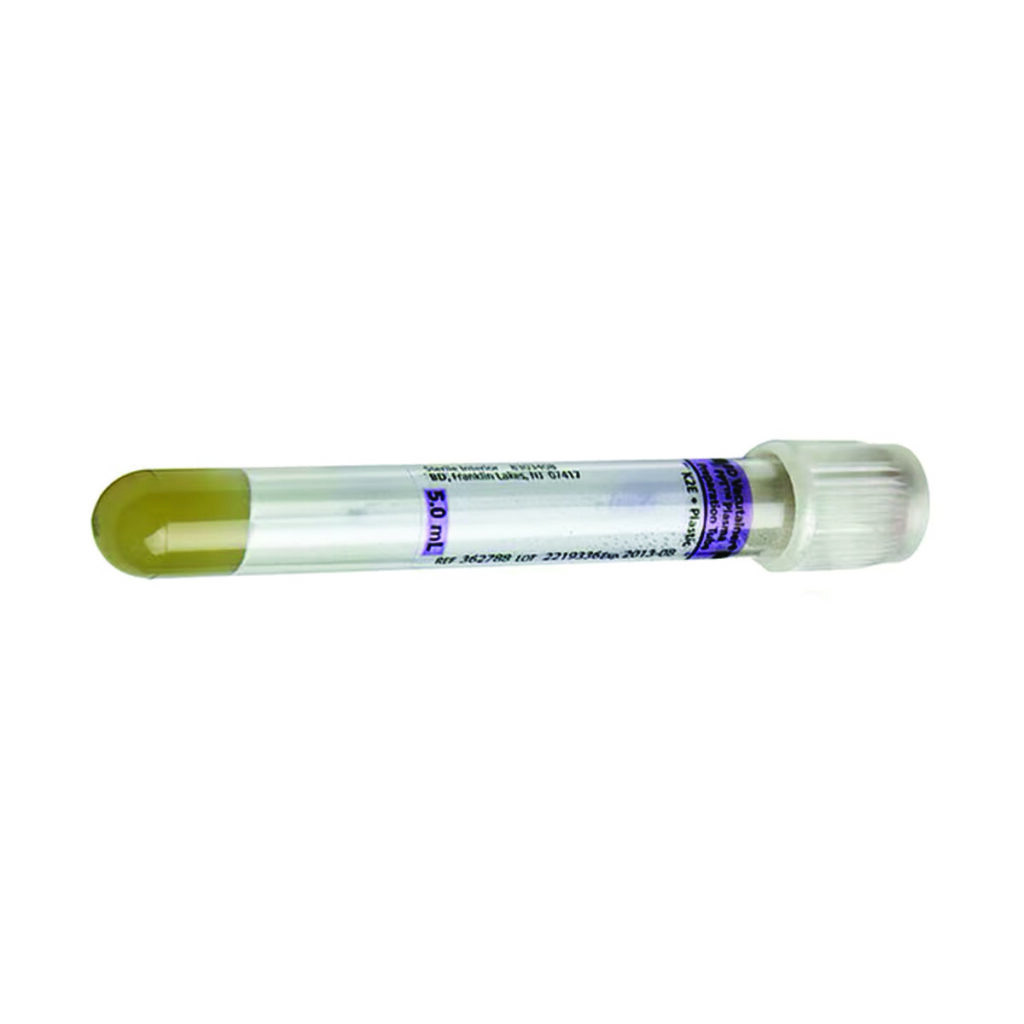 BD Vacutainer® Plus K2 EDTA Tube, White Hemogard, 5 mL