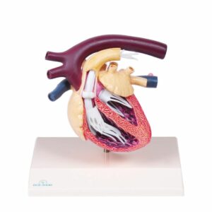 Canine Heart Model with Heartworm