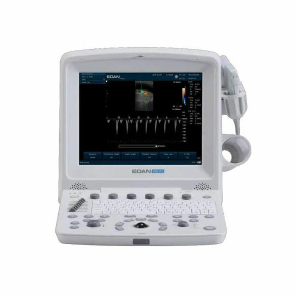 U50 Prime Vet Portable Veterinary Ultrasound System