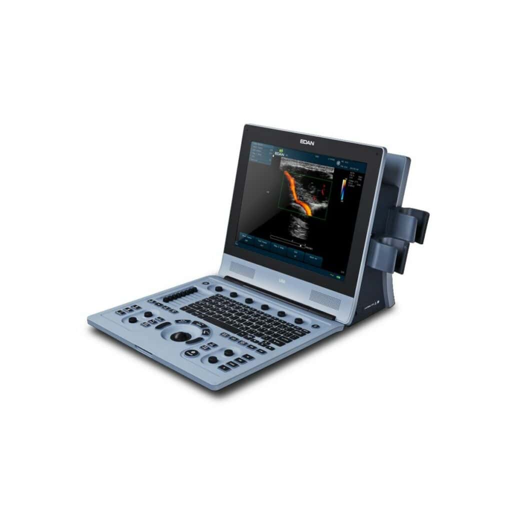 U60 Vet Portable Veterinary Ultrasound System